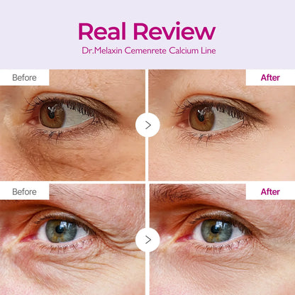 Dr.Melaxin Cemenrete Calcium Volume Multibalm